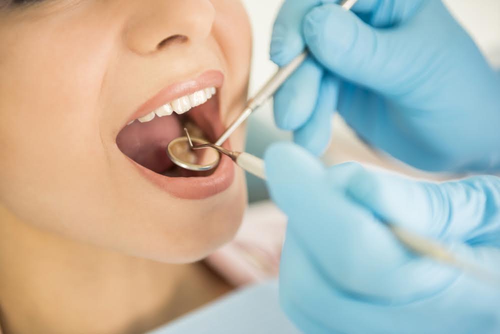 Periodoncia – Control periodontal y odontología conservadora