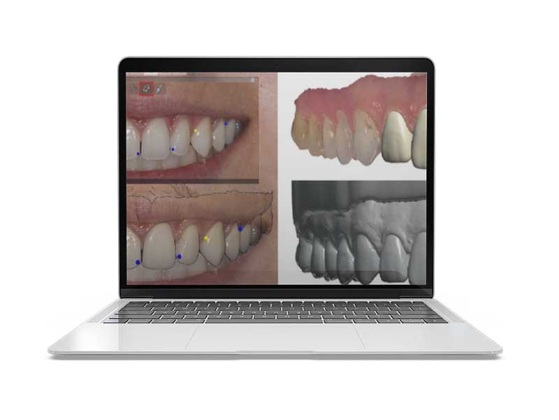 Diseno Digital de Sonrisas Dental System 3Shape Tecnología