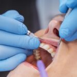 importancia higiene dental rodriguez Recio La importancia del cuidado de las encías